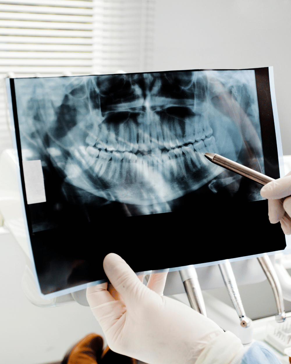 Endodonzia Treviso