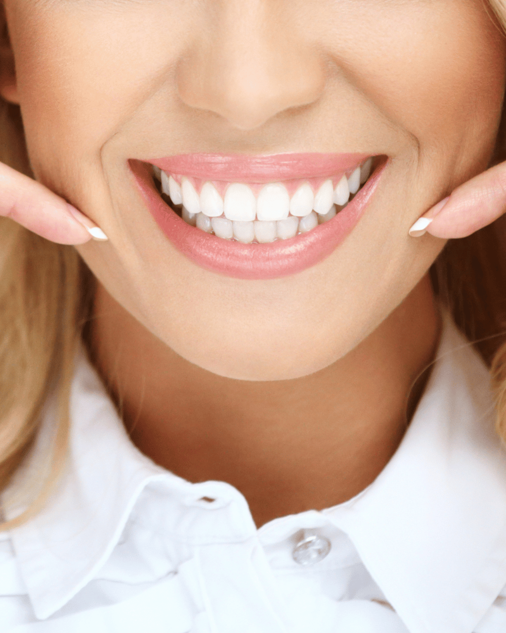 Riabilitazioni estetiche dentali a Treviso